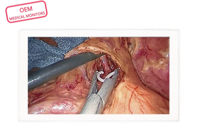 4K UHD medical monitor