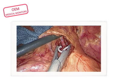 4K UHD medical monitor