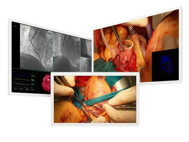 4K Large Medical Monitor