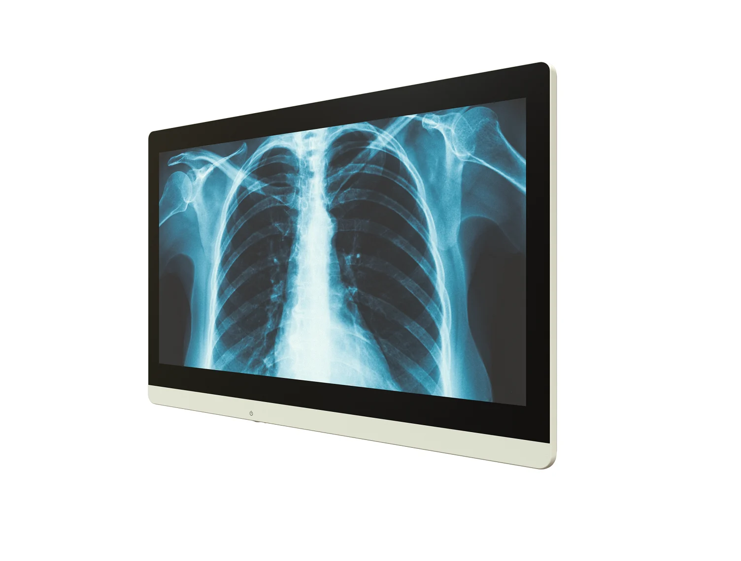 Medical monitor